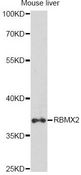 RBMX2 Antibody - Western blot analysis of extracts of mouse liver, using RBMX2 antibody at 1:1000 dilution. The secondary antibody used was an HRP Goat Anti-Rabbit IgG (H+L) at 1:10000 dilution. Lysates were loaded 25ug per lane and 3% nonfat dry milk in TBST was used for blocking. An ECL Kit was used for detection and the exposure time was 90s.