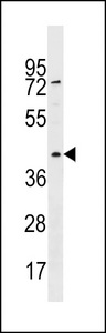 RBMXL1 Antibody - RBMXL1 Antibody western blot of HepG2 cell line lysates (35 ug/lane). The RBMXL1 antibody detected the RBMXL1 protein (arrow).