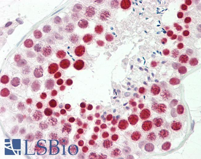 RBMXL2 Antibody - Anti-RBMXL2 antibody IHC staining of human testis. Immunohistochemistry of formalin-fixed, paraffin-embedded tissue after heat-induced antigen retrieval. Antibody concentration 5 ug/ml.  This image was taken for the unconjugated form of this product. Other forms have not been tested.