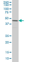 RBMXL2 Antibody - HNRNPG-T monoclonal antibody (M01), clone 6F11 Western blot of HNRNPG-T expression in HeLa.
