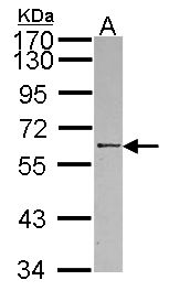RBMY1A1 Antibody - Sample (30 ug of whole cell lysate). A: NT2D1. 7.5% SDS PAGE. RBMY1A1 antibody diluted at 1:1000.