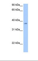 RBMY1A1 Antibody - Liver cell lysate. Antibody concentration: 0.5 ug/ml. Gel concentration: 12%.  This image was taken for the unconjugated form of this product. Other forms have not been tested.
