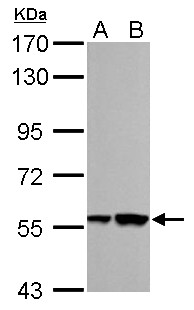 RBMY1A1 Antibody - RBMY1A1 antibody detects RBMY1A1 protein by Western blot analysis. A. 30 ug NT2D1 whole cell lysate/extract. B. 30 ug PC-3 whole cell lysate/extract. 7.5 % SDS-PAGE. RBMY1A1 antibody dilution:1:1000