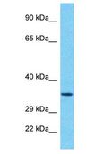 RBMY1A1 Antibody - RBMY1A1 antibody Western Blot of 293T. Antibody dilution: 1 ug/ml.  This image was taken for the unconjugated form of this product. Other forms have not been tested.