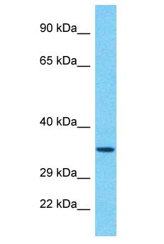 RBMY1A1 Antibody - RBMY1A1 antibody Western Blot of 293T. Antibody dilution: 1 ug/ml.  This image was taken for the unconjugated form of this product. Other forms have not been tested.