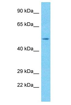 RBMY1A1 Antibody - RBMY1A1 antibody Western Blot of MCF7. Antibody dilution: 1 ug/ml.  This image was taken for the unconjugated form of this product. Other forms have not been tested.