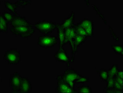 RBMY1A1 Antibody