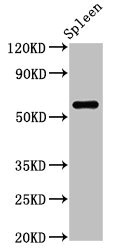 RBMY1A1 Antibody - Western Blot Positive WB detected in: Rat spleen tissue All lanes: RBMY1A1 antibody at 2.5µg/ml Secondary Goat polyclonal to rabbit IgG at 1/50000 dilution Predicted band size: 56, 52, 41 kDa Observed band size: 56 kDa