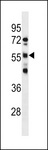 RBMY1D Antibody - RBMY1D Antibody western blot of NCI-H460 cell line lysates (35 ug/lane). The RBMY1D antibody detected the RBMY1D protein (arrow).