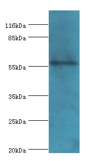 RBMY1F Antibody - Western blot. All lanes: RBMY1F antibody at 2 ug/ml+PC-3 whole cell lysate. Secondary antibody: Goat polyclonal to rabbit at 1:10000 dilution. Predicted band size: 56 kDa. Observed band size: 56 kDa.  This image was taken for the unconjugated form of this product. Other forms have not been tested.