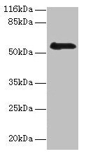 RBMY1F Antibody - Western blot All lanes: RBMY1F antibody at 2µg/ml + PC-3 whole cell lysate Secondary Goat polyclonal to rabbit IgG at 1/10000 dilution Predicted band size: 56, 48 kDa Observed band size: 56 kDa