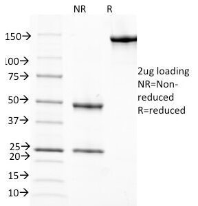 RBP / Retinol Binding Protein Antibody - SDS-PAGE Analysis of Purified, BSA-Free RBP Antibody (clone G4E4). Confirmation of Integrity and Purity of the Antibody.