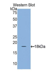 RBP1 / CRBP Antibody - Western blot of recombinant RBP1 / CRBP.  This image was taken for the unconjugated form of this product. Other forms have not been tested.