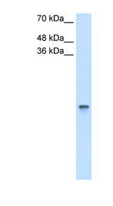 RBP1 / CRBP Antibody - RBP1 antibody ARP42081_T100-NP_002890-RBP1(retinol binding protein 1, cellular) Antibody Western blot of HCT116 cell lysate.  This image was taken for the unconjugated form of this product. Other forms have not been tested.
