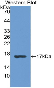 RBP1 / CRBP Antibody - Western blot of RBP1 / CRBP antibody.