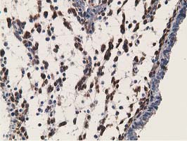 RBP1 / CRBP Antibody - IHC of paraffin-embedded Human endometrium tissue using anti-RBP1 mouse monoclonal antibody.