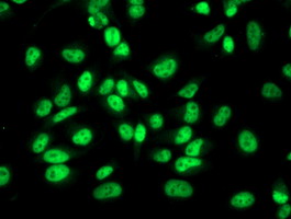RBP1 / CRBP Antibody - Immunofluorescent staining of HeLa cells using anti-RBP1 mouse monoclonal antibody.