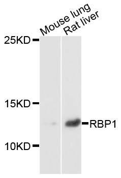 RBP1 / CRBP Antibody - Western blot analysis of extracts of various cells.