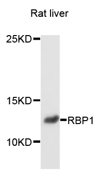RBP1 / CRBP Antibody - Western blot analysis of extracts of rat liver, using RBP1 antibody at 1:1000 dilution. The secondary antibody used was an HRP Goat Anti-Rabbit IgG (H+L) at 1:10000 dilution. Lysates were loaded 25ug per lane and 3% nonfat dry milk in TBST was used for blocking. An ECL Kit was used for detection and the exposure time was 90s.