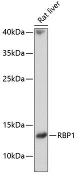 RBP1 / CRBP Antibody - Western blot analysis of extracts of rat liver using RBP1 Polyclonal Antibody at dilution of 1:1000.