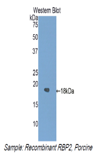 RBP2 / CRBPII Antibody - Western blot of recombinant RBP2 / CRBPII.  This image was taken for the unconjugated form of this product. Other forms have not been tested.