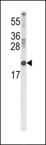 RBP2 / CRBPII Antibody - Western blot of RBP2 Antibody in 293 cell line lysates (35 ug/lane). RBP2 (arrow) was detected using the purified antibody.