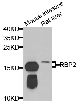 RBP2 / CRBPII Antibody - Western blot analysis of extracts of various cells.