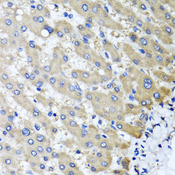 RBP2 / CRBPII Antibody - Immunohistochemistry of paraffin-embedded human liver injury tissue.