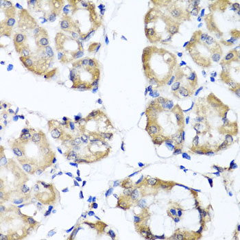 RBP2 / CRBPII Antibody - Immunohistochemistry of paraffin-embedded human stomach tissue.