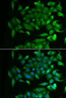 RBP2 / CRBPII Antibody - Immunofluorescence analysis of MCF-7 cells.