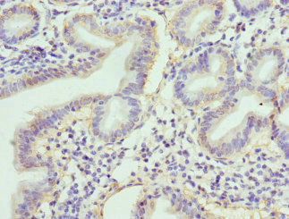 RBP2 / CRBPII Antibody - Immunohistochemistry of paraffin-embedded human duodenal tissue at dilution 1:100