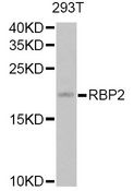 RBP2 / CRBPII Antibody - Western blot analysis of extracts of 293T cells, using RBP2 Antibody at 1:1000 dilution. The secondary antibody used was an HRP Goat Anti-Rabbit IgG (H+L) at 1:10000 dilution. Lysates were loaded 25ug per lane and 3% nonfat dry milk in TBST was used for blocking. An ECL Kit was used for detection and the exposure time was 60s.