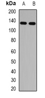 RBP3 / IRBP Antibody - Western blot analysis of IRBP expression in mouse lung (A); rat eye (B) whole cell lysates.