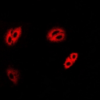 RBP3 / IRBP Antibody - Immunofluorescent analysis of IRBP staining in MCF7 cells. Formalin-fixed cells were permeabilized with 0.1% Triton X-100 in TBS for 5-10 minutes and blocked with 3% BSA-PBS for 30 minutes at room temperature. Cells were probed with the primary antibody in 3% BSA-PBS and incubated overnight at 4 deg C in a humidified chamber. Cells were washed with PBST and incubated with a DyLight 594-conjugated secondary antibody (red) in PBS at room temperature in the dark.