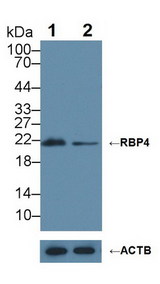 RBP4 Antibody - Knockout Varification: Lane 1: Wild-type HepG2 cell lysate; Lane 2: RBP4 knockout HepG2 cell lysate; Predicted MW: 21kDa Observed MW: 21kDa Primary Ab: 1µg/ml Rabbit Anti-Bovine RBP4 Antibody Second Ab: 0.2µg/mL HRP-Linked Caprine Anti-Rabbit IgG Polyclonal Antibody