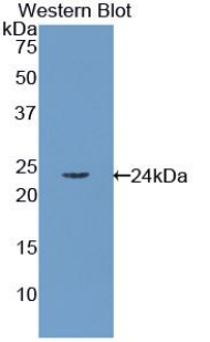 RBP4 Antibody - Western blot of recombinant RBP / RBP4.  This image was taken for the unconjugated form of this product. Other forms have not been tested.