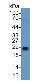 RBP4 Antibody - Western Blot; Sample: Human Serum; Primary Ab: 1µg/ml Rabbit Anti-Human RBP4 Antibody Second Ab: 0.2µg/mL HRP-Linked Caprine Anti-Rabbit IgG Polyclonal Antibody