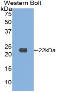 RBP4 Antibody - Western blot of recombinant RBP / RBP4.  This image was taken for the unconjugated form of this product. Other forms have not been tested.