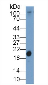 RBP4 Antibody - Western Blot; Sample: Gallus Serum; Primary Ab: 1µg/ml Rabbit Anti-Gallus RBP4 Antibody Second Ab: 0.2µg/mL HRP-Linked Caprine Anti-Rabbit IgG Polyclonal Antibody