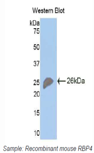 RBP4 Antibody - Western blot of recombinant RBP / RBP4.  This image was taken for the unconjugated form of this product. Other forms have not been tested.
