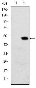 RBP4 Antibody - Western blot using RBP4 monoclonal antibody against HEK293 (1) and RBP4(AA: 1-201)-hIgGFc transfected HEK293 (2) cell lysate.