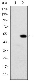 RBP4 Antibody - RBP4 Antibody in Western Blot (WB)