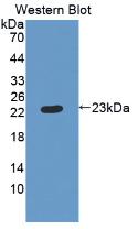 RBP4 Antibody - WesternBlot;Sample:RecombinantRBP4,Human.