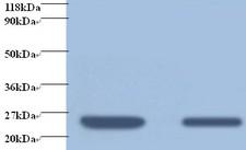 RBP4 Antibody - Western blot of human Retinol-binding protein 4 antibody at 2 ug/ml + human positive serum. Lane 1: positive serum at 1:10. Lane 2: positive serum at 1:100. Secondary: Goat polyclonal to Rabbit IgG at 1:5000 dilution. Predicted band size:22 kDa. Observed band size: 22 kDa-23 kDa.  This image was taken for the unconjugated form of this product. Other forms have not been tested.