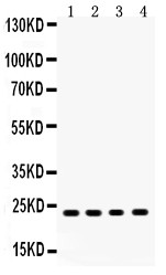 RBP4 Antibody - RBP4 antibody Western blot. All lanes: Anti RBP4 at 0.5 ug/ml. Lane 1: Rat Liver Tissue Lysate at 50 ug. Lane 2: Mouse Liver Tissue Lysate at 50 ug. Lane 3: HEPG2 Whole Cell Lysate at 40 ug. Lane 4: COLO320 Whole Cell Lysate at 40 ug. Predicted band size: 23 kD. Observed band size: 23 kD.