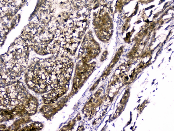 RBP4 Antibody - IHC analysis of RBP4 using anti-RBP4 antibody. RBP4 was detected in paraffin-embedded section of mouse kidney tissues. Heat mediated antigen retrieval was performed in citrate buffer (pH6, epitope retrieval solution) for 20 mins. The tissue section was blocked with 10% goat serum. The tissue section was then incubated with 1µg/ml rabbit anti-RBP4 Antibody overnight at 4°C. Biotinylated goat anti-rabbit IgG was used as secondary antibody and incubated for 30 minutes at 37°C. The tissue section was developed using Strepavidin-Biotin-Complex (SABC) with DAB as the chromogen.