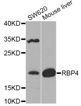 RBP4 Antibody - Western blot analysis of extracts of various cell lines, using RBP4 Antibody at 1:1000 dilution. The secondary antibody used was an HRP Goat Anti-Rabbit IgG (H+L) at 1:10000 dilution. Lysates were loaded 25ug per lane and 3% nonfat dry milk in TBST was used for blocking.