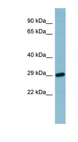 RBP4 Antibody - RBP4 antibody Western blot of Fetal Stomach lysate. This image was taken for the unconjugated form of this product. Other forms have not been tested.