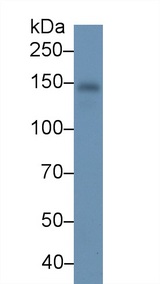 RBP4 Antibody - Western Blot; Sample: Human Serum; Primary Ab: 3µg/ml Mouse Anti-Human CP Antibody Second Ab: 0.2µg/mL HRP-Linked Caprine Anti-Mouse IgG Polyclonal Antibody