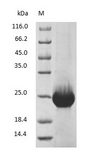 RBP4 Protein - (Tris-Glycine gel) Discontinuous SDS-PAGE (reduced) with 5% enrichment gel and 15% separation gel.